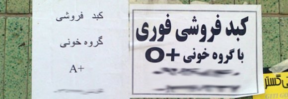 کبد فروشی در خیابان