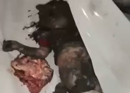 دل و روده کودک فلسطینی کف دست پدرش!