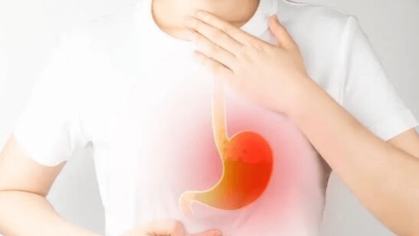چگونه رفلاکس نگیریم