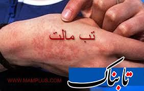 با رعایت این نکات از تب مالت در امان بمانید