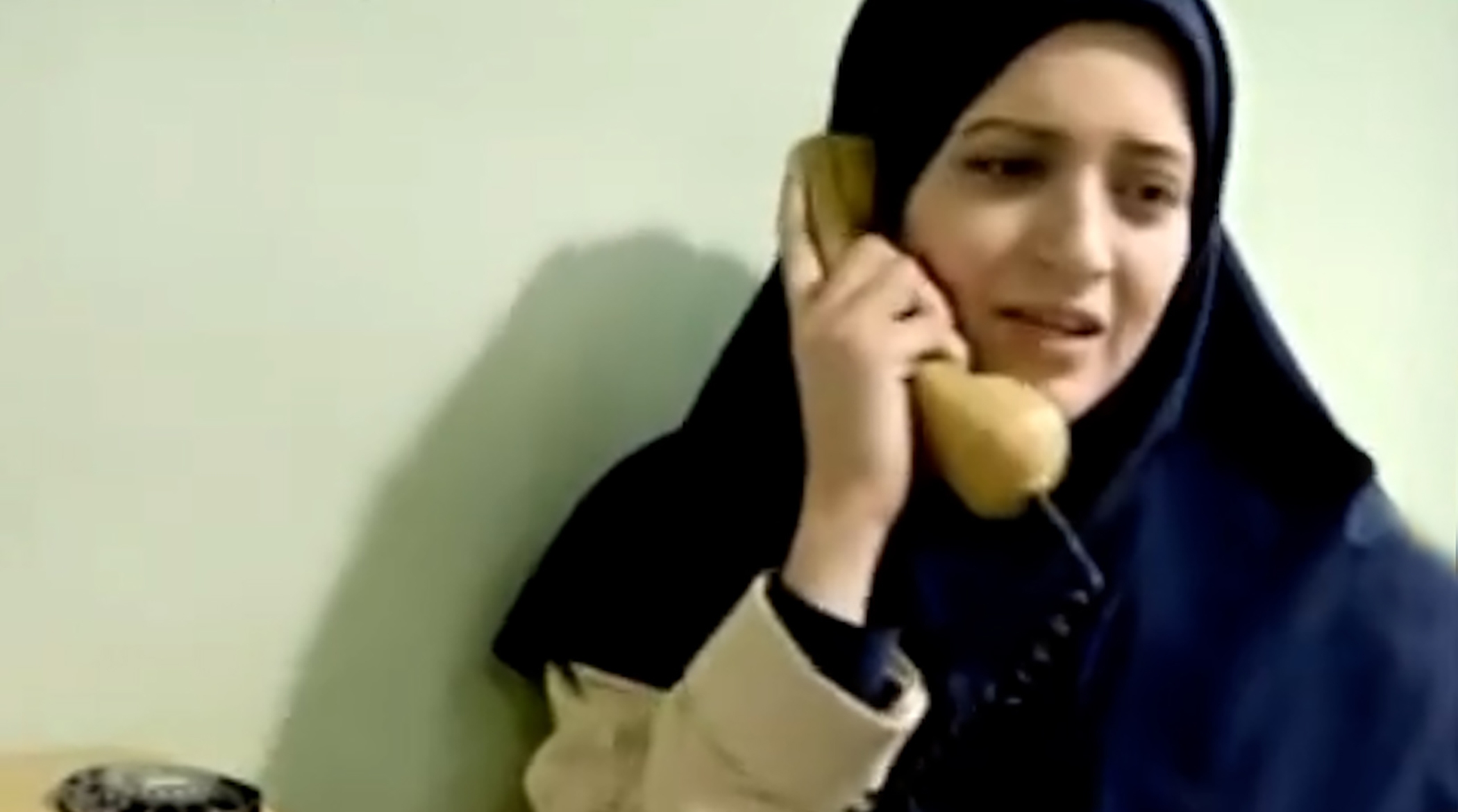 تصاویر بهنوش طباطبایی قبل از عمل سنگین زیبایی