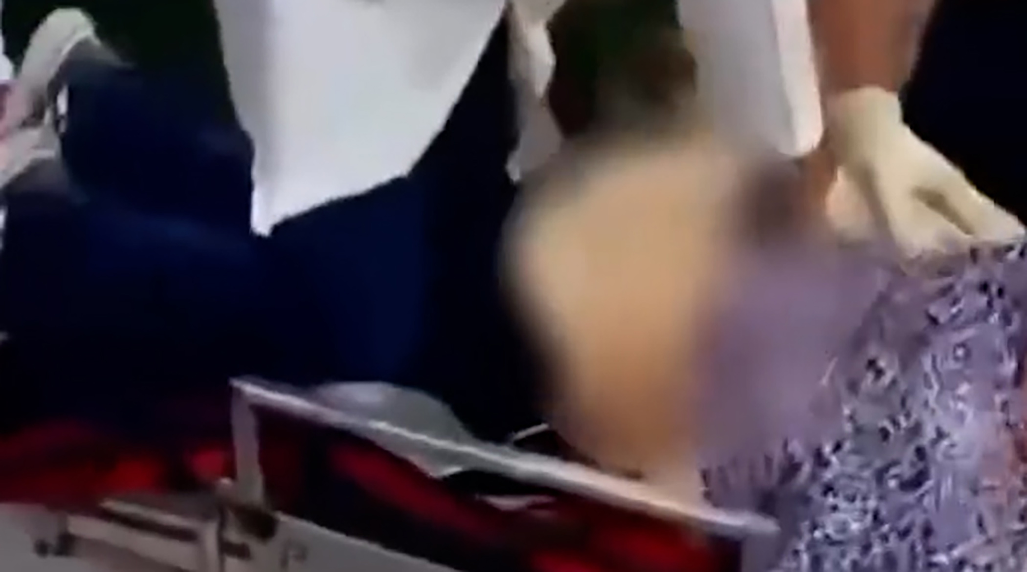 لحظات نجات معجزه آسا یک بیمار در قائمشهر