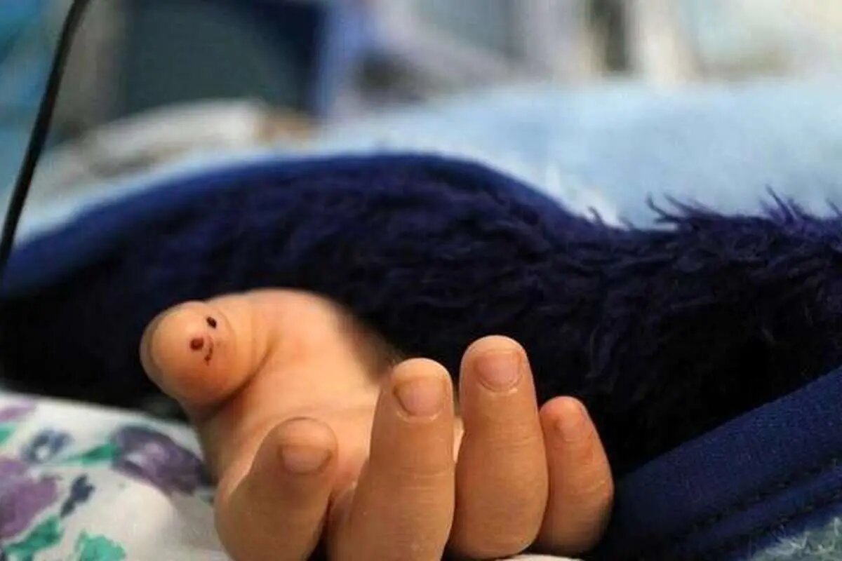 مرگ تلخ دختر ۳ ساله بر اثر عقربگزیدگی